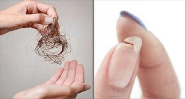 You-Need-To-Eat-This-If-You-Have-Hair-Loss-Brittle-Nails-Or-Youu2019re-Not-Sleeping-Well
